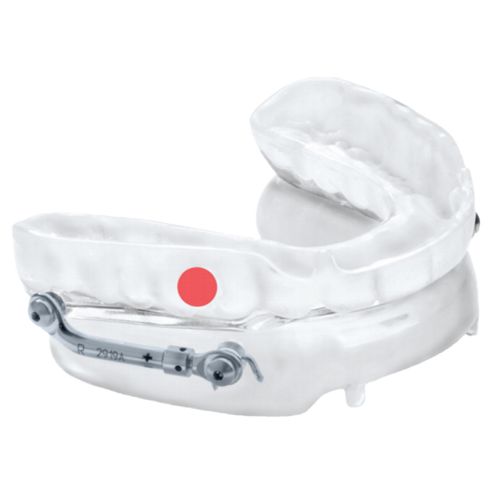 Titrate FDAApproved Oral Appliance for Sleep Apnea BlueSleep